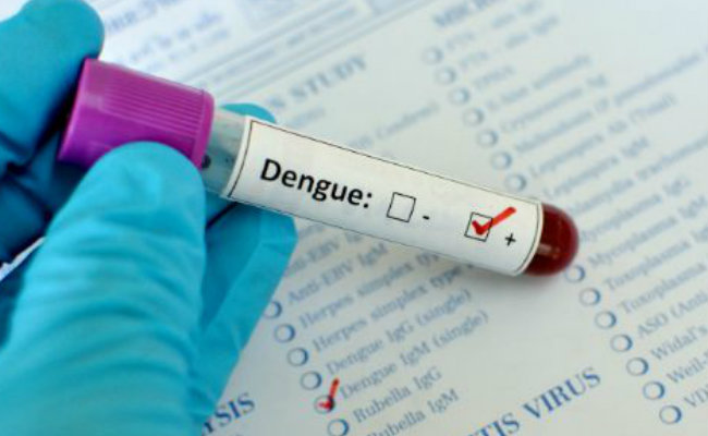 dengue sample